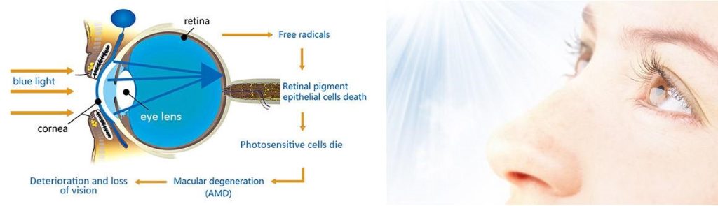 Aggravating macular diseases